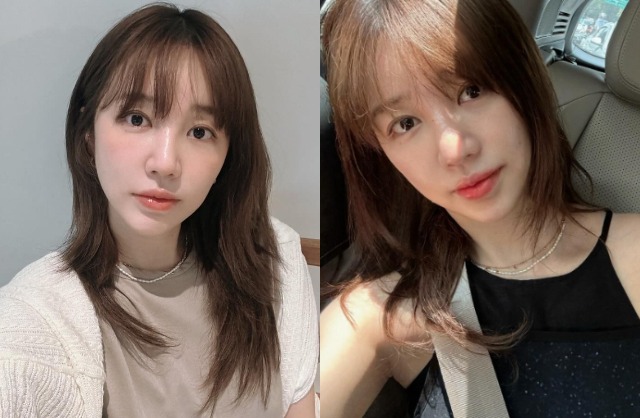 Yoon Eun Hye lộ chuyện bị tạt axit suýt mù, chịu hậu quả ám ảnh- Ảnh 9.