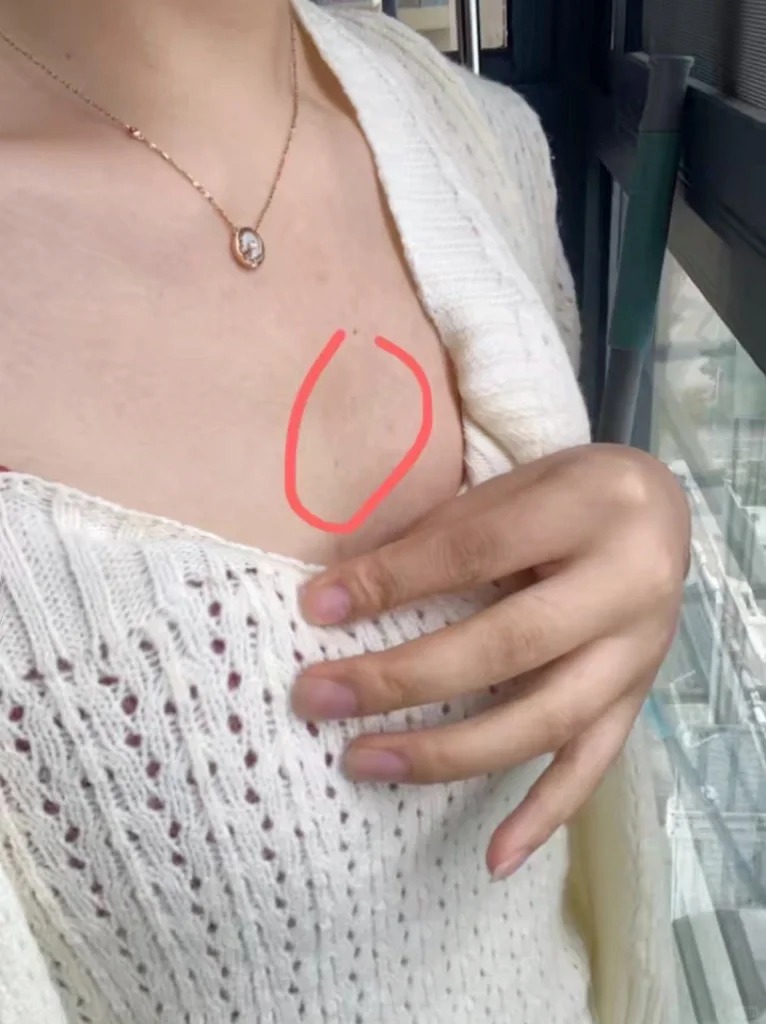 Cứ tưởng là tiện nhưng tôi hối hận khi dùng miếng dán ngực thường xuyên- Ảnh 6.