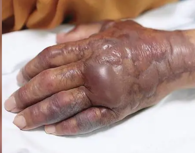 Hàn Quốc khuyến cáo tránh ăn hải sản sống vì "vi khuẩn ăn thịt người"- Ảnh 2.