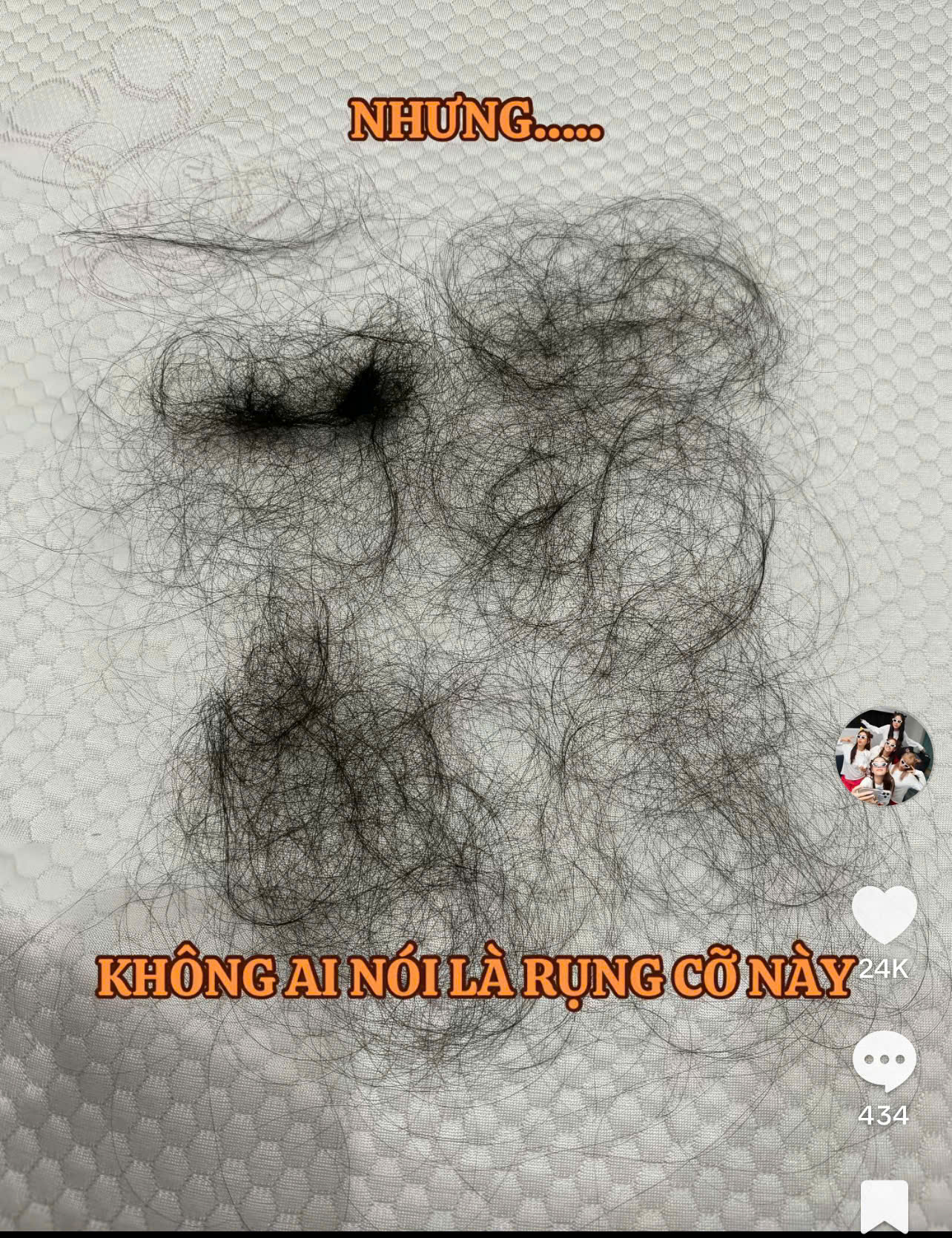 Puka gây lo lắng khi tóc rụng la liệt thành từng mảng sau khi sinh con đầu lòng- Ảnh 2.