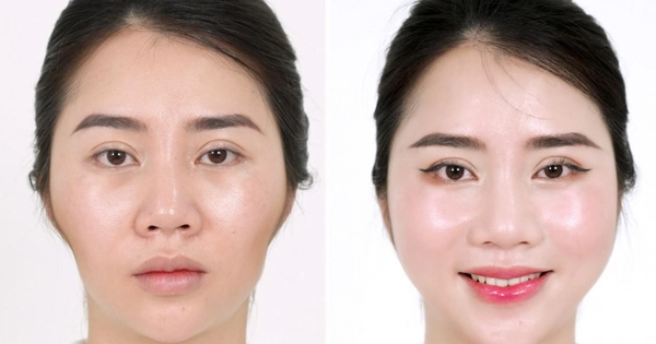 Huyền Lizzie đam mê 1 kiểu làm đẹp lấp đầy má hóp, thái dương lõm, "cá sấu chúa" Quỳnh Nga cũng kết thân để nhan sắc ngọt ngào, e ấp như thiếu nữ đôi mươi- Ảnh 10.