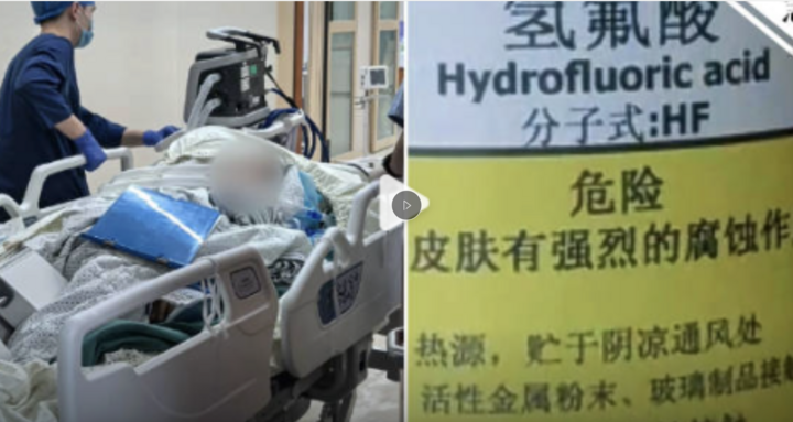 Giẫm phải ‘nước hòa tan xương’ khi đi dạo, người phụ nữ chết sau 5 ngày- Ảnh 1.