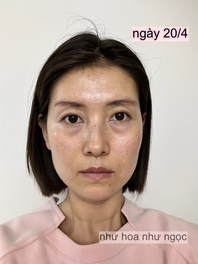 Chụp ảnh mặt mộc hàng ngày trong 1 tháng uống collagen, có điểm này trên mặt thay đổi mà tôi thấy rõ- Ảnh 4.