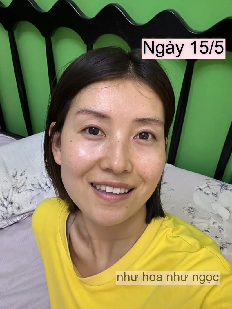 Chụp ảnh mặt mộc hàng ngày trong 1 tháng uống collagen, có điểm này trên mặt thay đổi mà tôi thấy rõ- Ảnh 5.