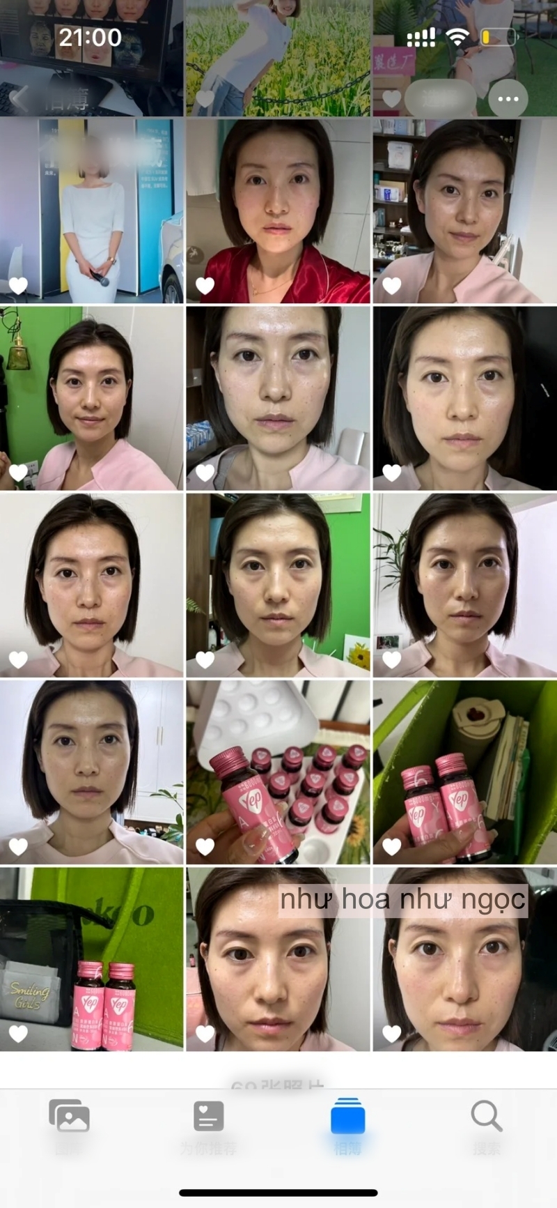 Chụp ảnh mặt mộc hàng ngày trong 1 tháng uống collagen, có điểm này trên mặt thay đổi mà tôi thấy rõ- Ảnh 7.