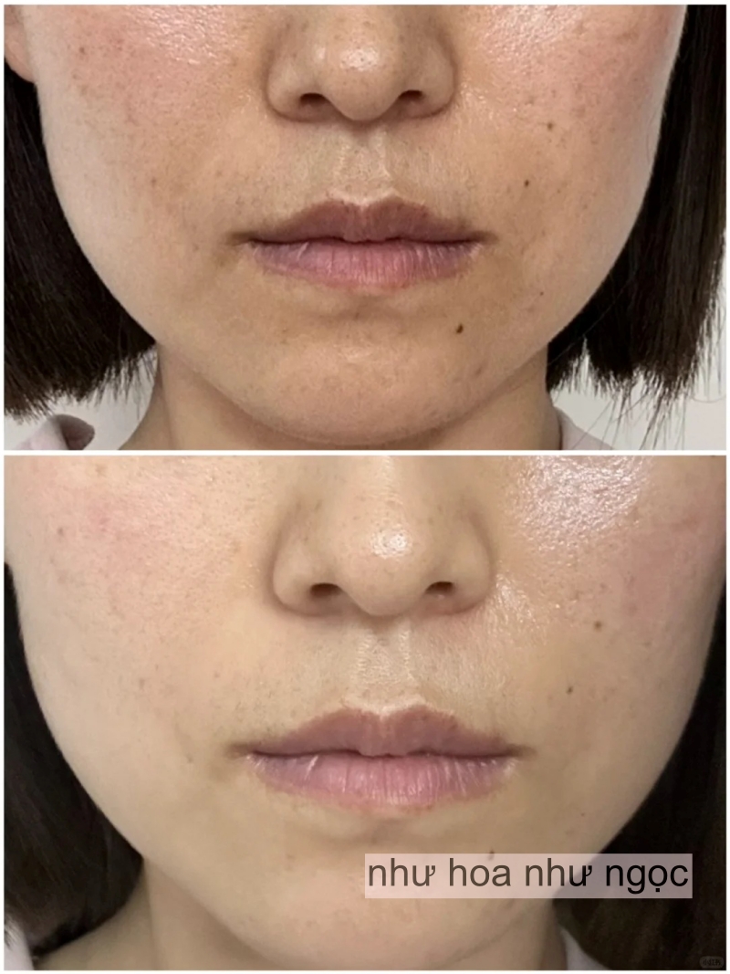 Chụp ảnh mặt mộc hàng ngày trong 1 tháng uống collagen, có điểm này trên mặt thay đổi mà tôi thấy rõ- Ảnh 6.