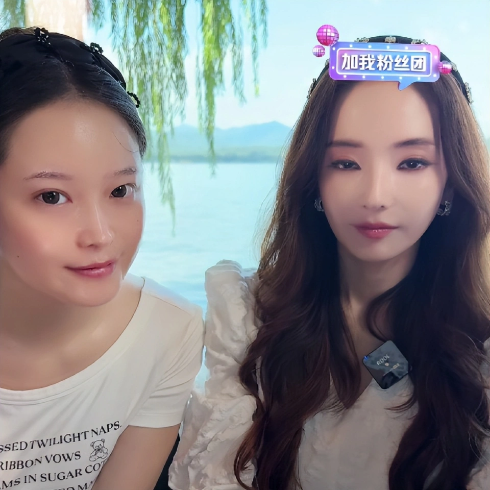 Mỹ nhân đẹp nhất Vườn Sao Băng làm sao thế này: Mặt mũi đơ như tượng, mắt lờ đờ, miệng cũng không mở nổi!- Ảnh 3.