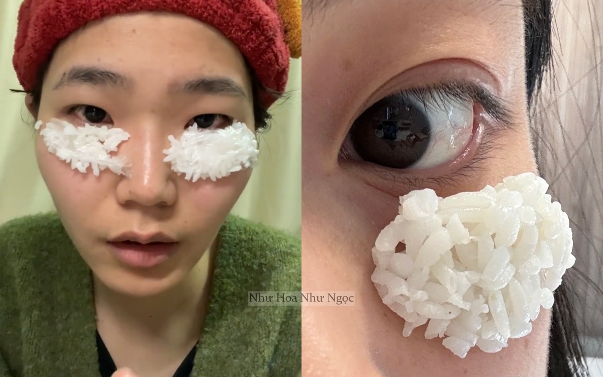 Cô nàng đắp cơm lên mắt, tưởng vô dụng nhưng bất ngờ khiến nếp nhăn giảm đi thấy rõ- Ảnh 1.