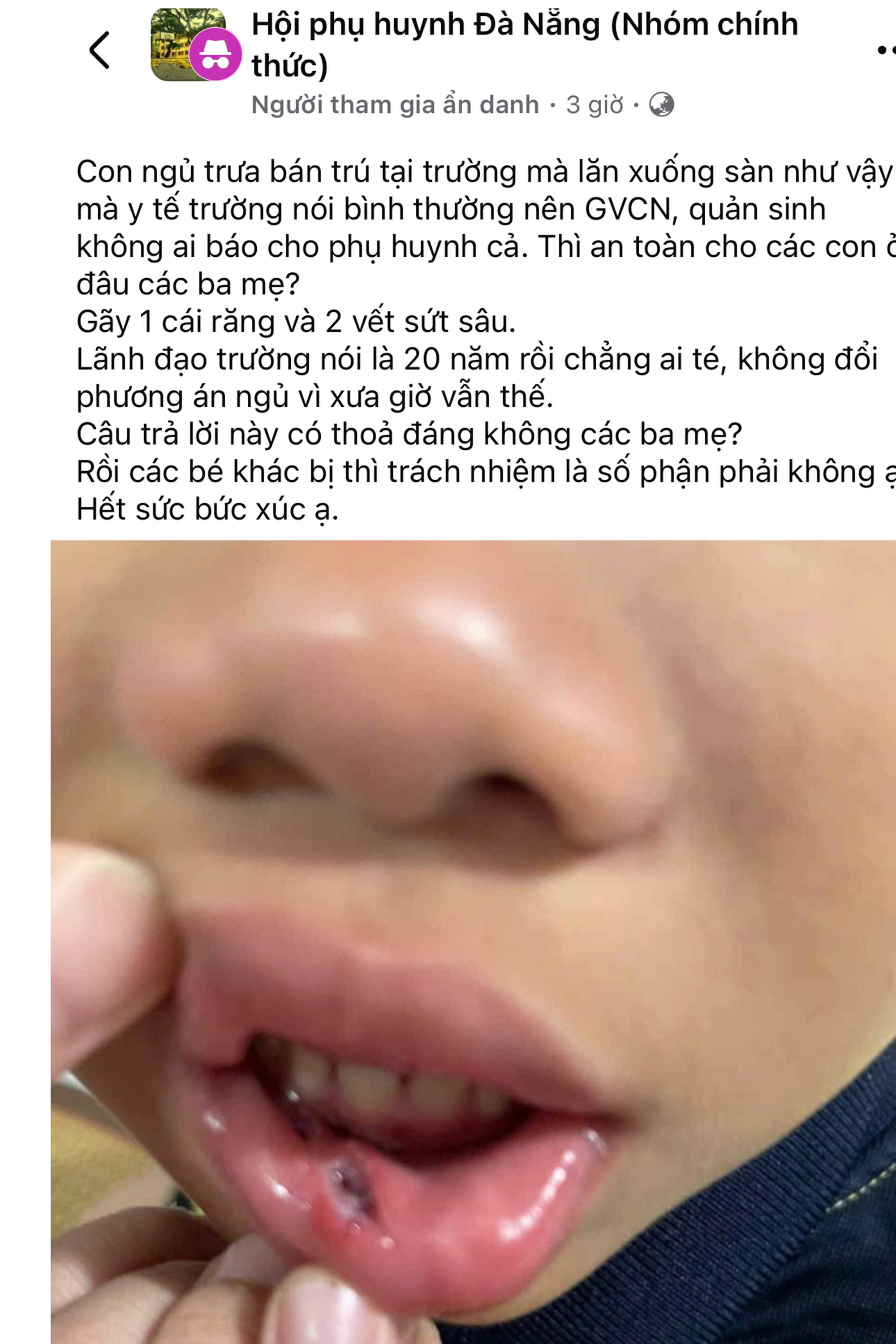 Đà Nẵng: Lãnh đạo trường tiểu học lên tiếng việc học sinh ngã xuống đất giờ ngủ trưa- Ảnh 1.