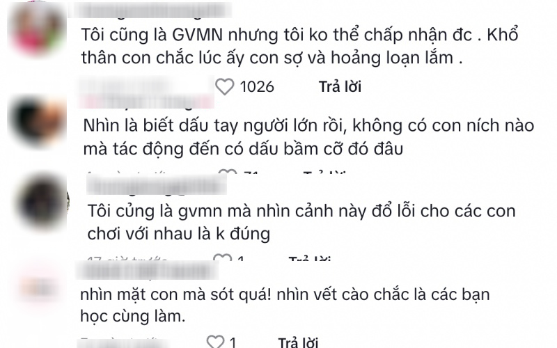 Xôn xao sự việc đón con đi học về thấy in hằn vết tay tấy đỏ khắp mặt, lời giải thích vô lý của giáo viên càng khiến dân tình bức xúc- Ảnh 2.