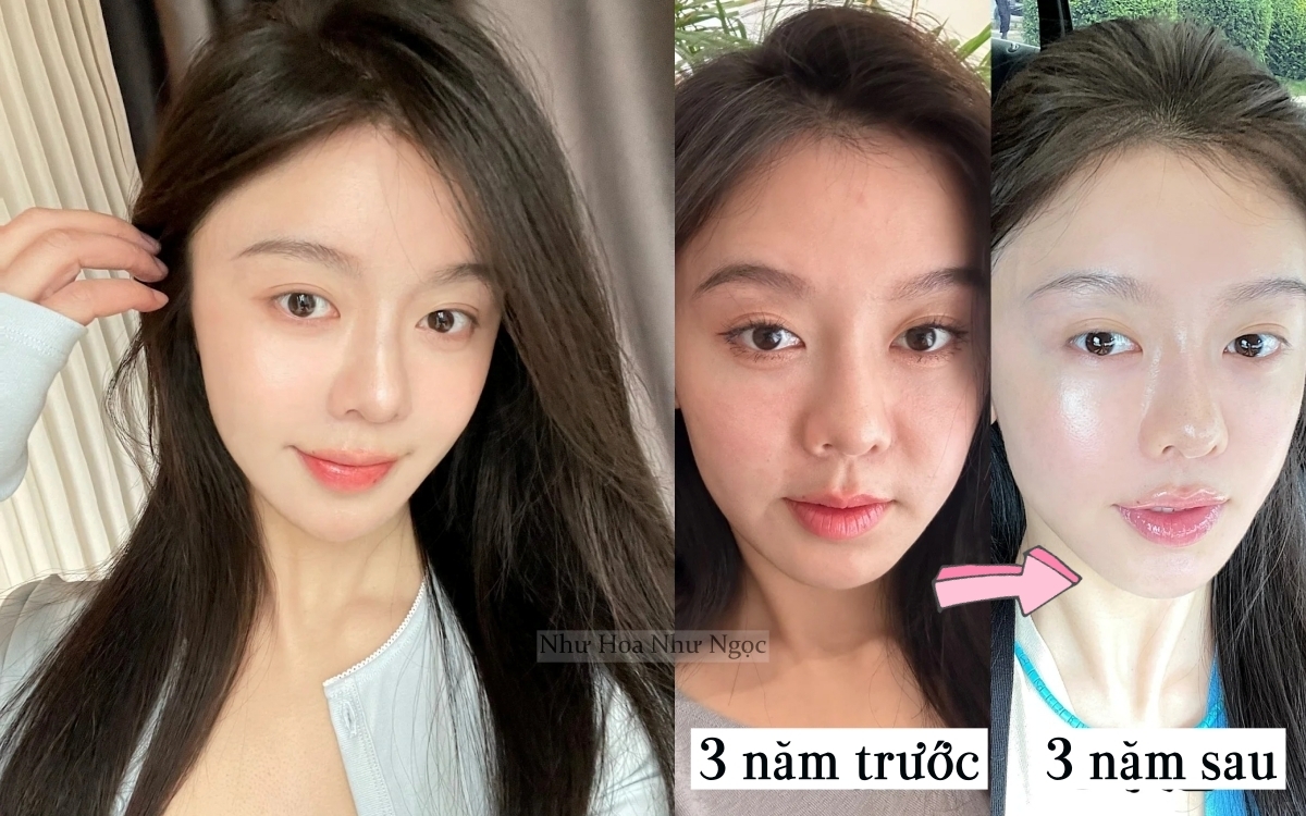 3 năm dưỡng nhan từ trong ra ngoài, người phụ nữ này trông như "đổi mặt" mà không hề nhờ tới dao kéo- Ảnh 3.