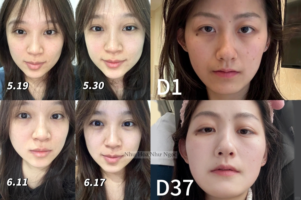 Cách dưỡng da "không tốn một đồng" nhưng cực hiệu quả của phụ nữ Trung Quốc- Ảnh 5.