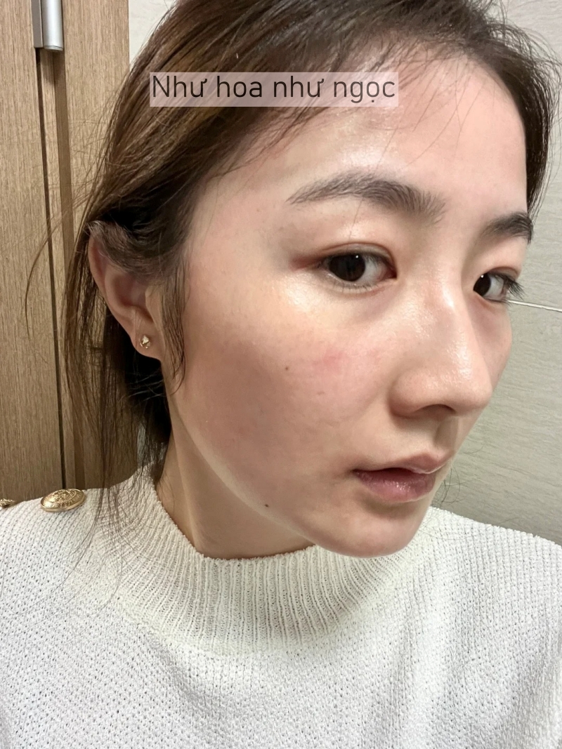 Tôi đã bù đắp lại lượng collagen đã mất bằng cách làm điều này mỗi tối trước khi ngủ- Ảnh 7.