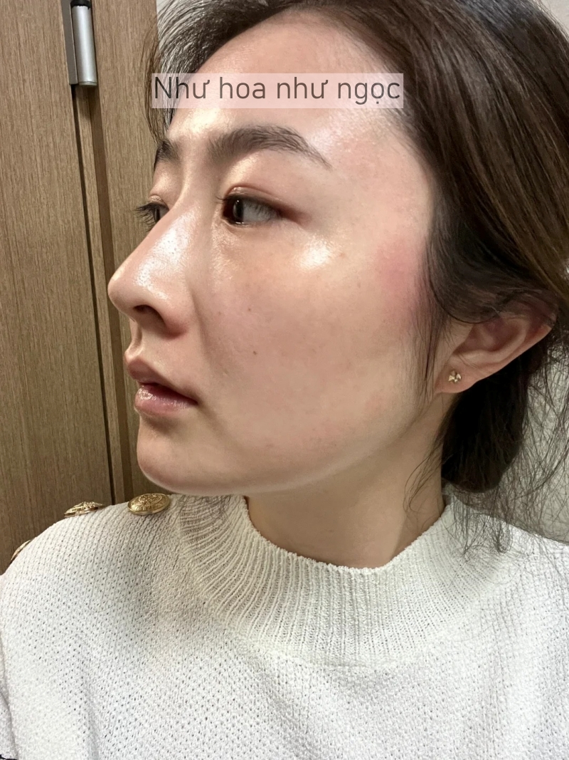 Tôi đã bù đắp lại lượng collagen đã mất bằng cách làm điều này mỗi tối trước khi ngủ- Ảnh 5.