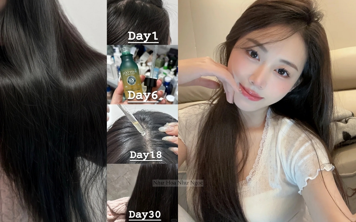 5 lọ serum "chân ái" cho hội rụng tóc, ngoài hiệu quả chống rụng thì còn giúp tóc bóng mướt từ chân- Ảnh 1.