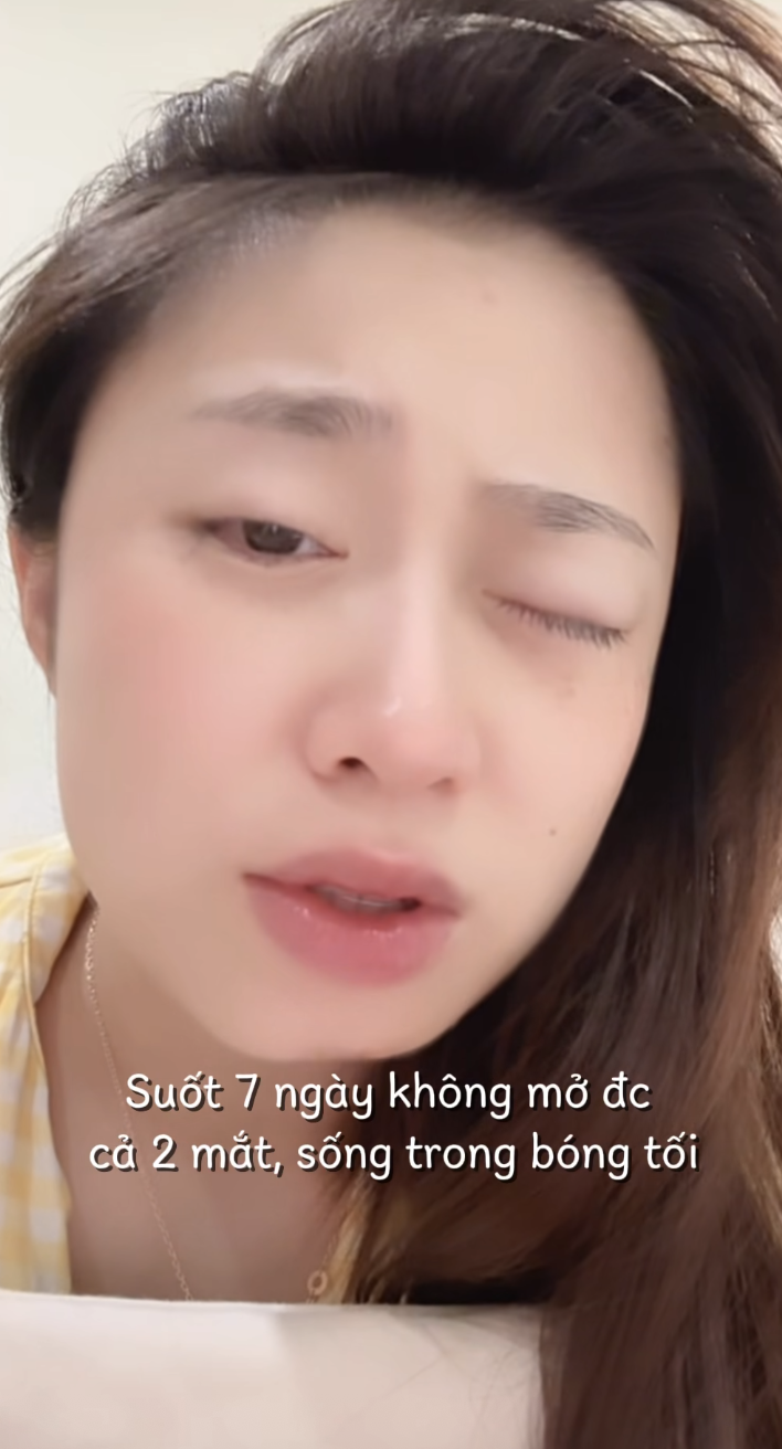 Đang chơi cùng con, TikToker "Ngọc Khánh Đây" bị thẻ đọc chữ đâm vào mắt, rách gần hết giác mạc- Ảnh 1.