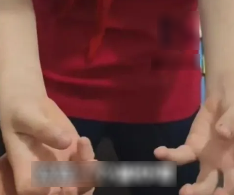 B&eacute; trai 11 tuổi tay co giật, kh&oacute; thở sau khi l&agrave;m b&agrave;i tập về nh&agrave; suốt 14 tiếng- Ảnh 1.