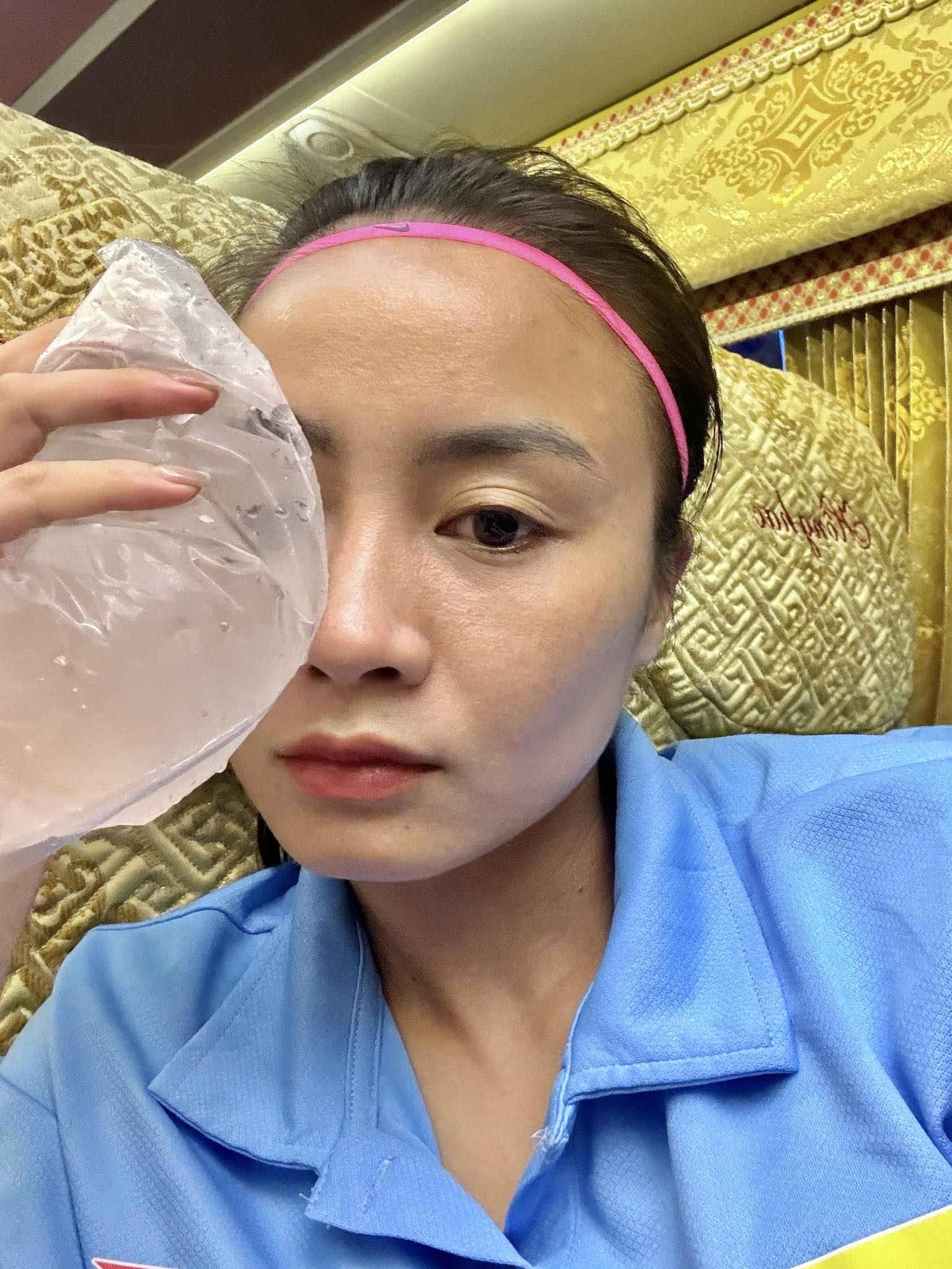 Hotgirl bóng đá Hoàng Thị Loan để lộ vùng mắt sưng vù sau pha va chạm trên sân bóng khiến fan cực xót- Ảnh 1.