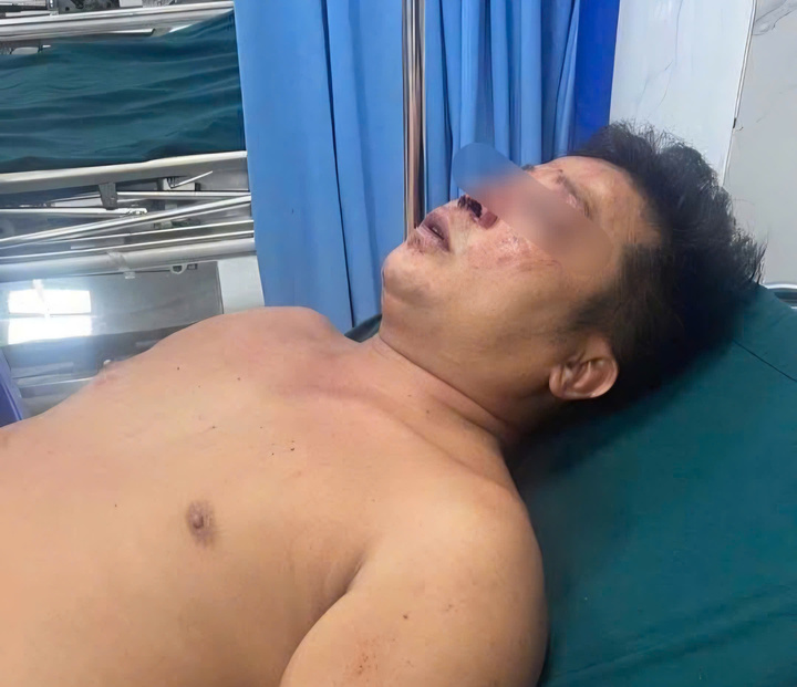 Điều tra vụ người đàn ông bị hành hung khi giúp người đi đường gặp nạn- Ảnh 2.