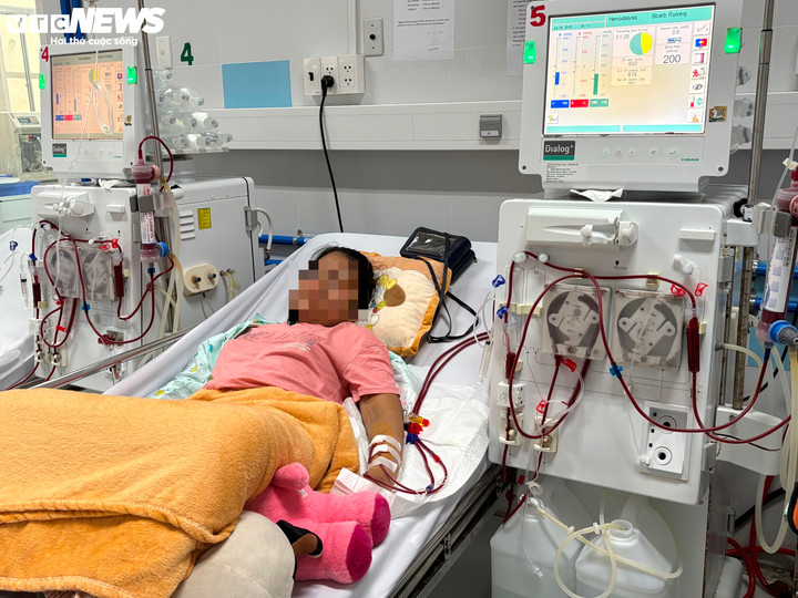 Ph&aacute;t hiện muộn suy thận mạn, nhiều trẻ sống phụ thuộc v&agrave;o m&aacute;y lọc m&aacute;u- Ảnh 3.