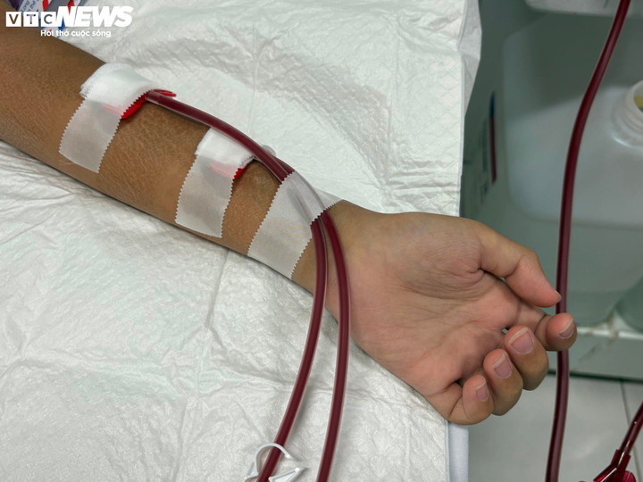 Ph&aacute;t hiện muộn suy thận mạn, nhiều trẻ sống phụ thuộc v&agrave;o m&aacute;y lọc m&aacute;u- Ảnh 2.