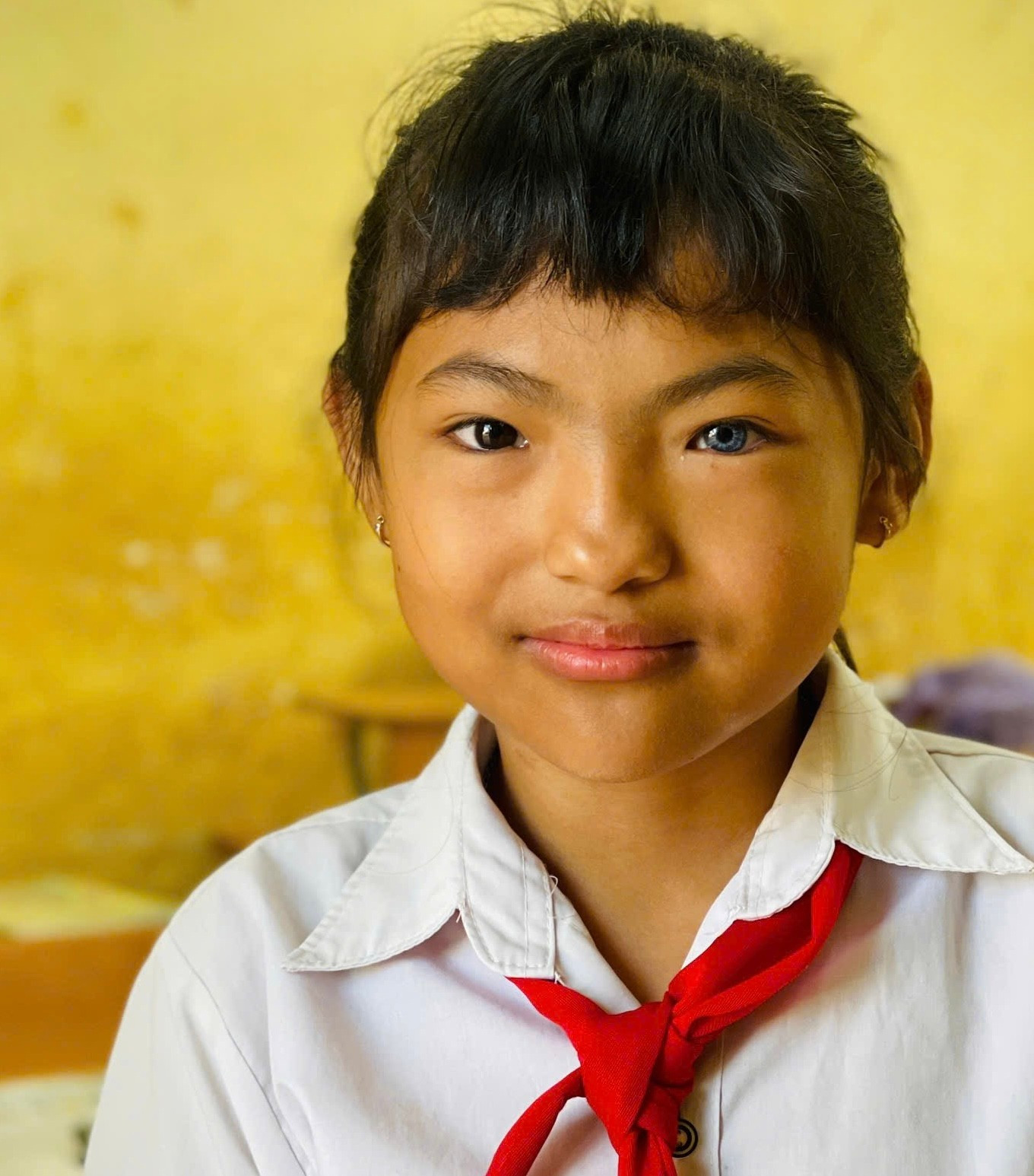 C&ocirc; b&eacute; c&oacute; đ&ocirc;i mắt "&acirc;m dương" kỳ lạ ở T&acirc;y Nguy&ecirc;n- Ảnh 1.