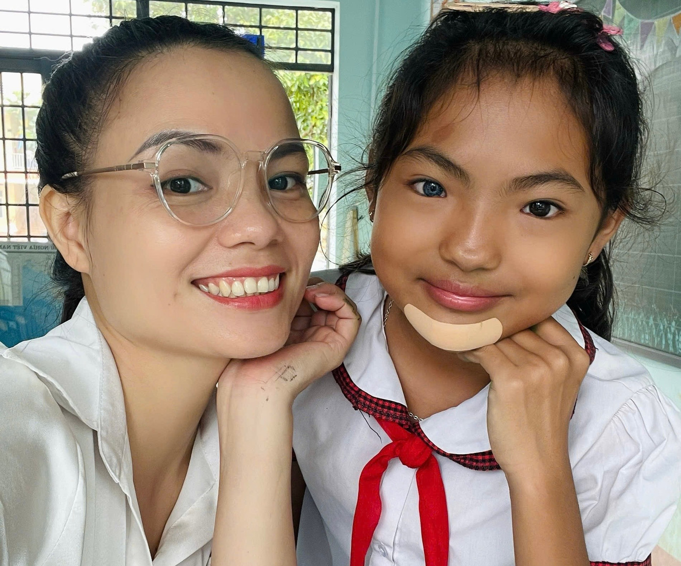 C&ocirc; b&eacute; c&oacute; đ&ocirc;i mắt "&acirc;m dương" kỳ lạ ở T&acirc;y Nguy&ecirc;n- Ảnh 3.