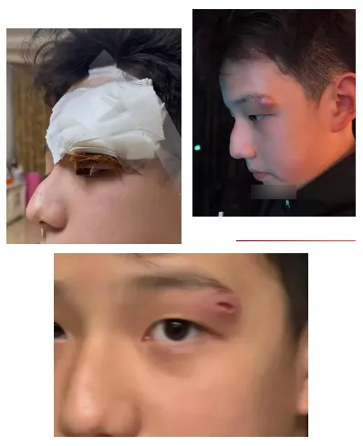 Một nữ diễn vi&ecirc;n nổi tiếng l&agrave;m 1 việc khiến con trai phải kh&acirc;u tới 4 mũi- Ảnh 1.