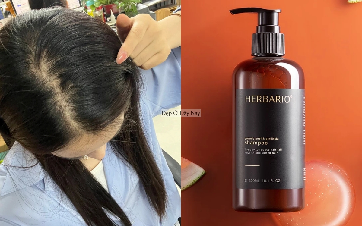 Muốn t&oacute;c mọc nhanh, khỏe v&agrave; d&agrave;y hơn th&igrave; nhất định phải sử dụng 5 sản phẩm n&agrave;y- Ảnh 3.