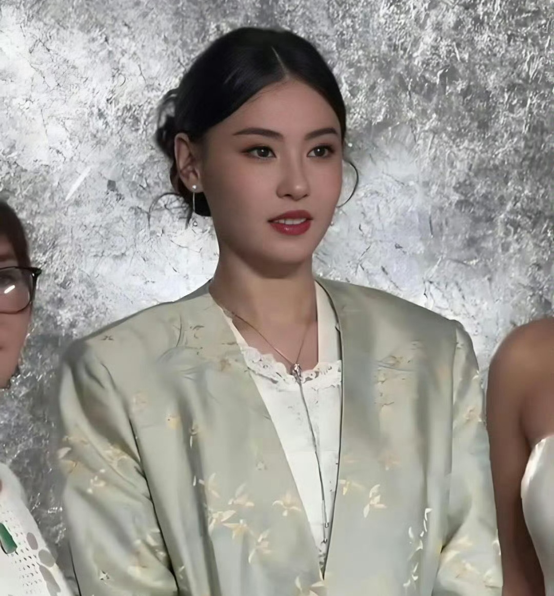 Cam thường mới kh&ocirc;ng c&ograve;n vết t&iacute;ch thẩm mỹ của Trương B&aacute; Chi- Ảnh 12.