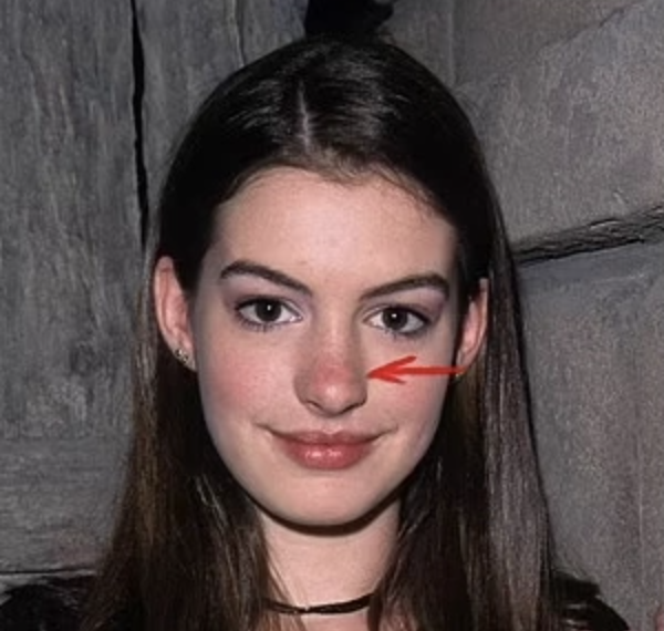 Quảng c&aacute;o sản phẩm chống l&atilde;o ho&aacute; của Anne Hathaway g&acirc;y tranh c&atilde;i- Ảnh 11.