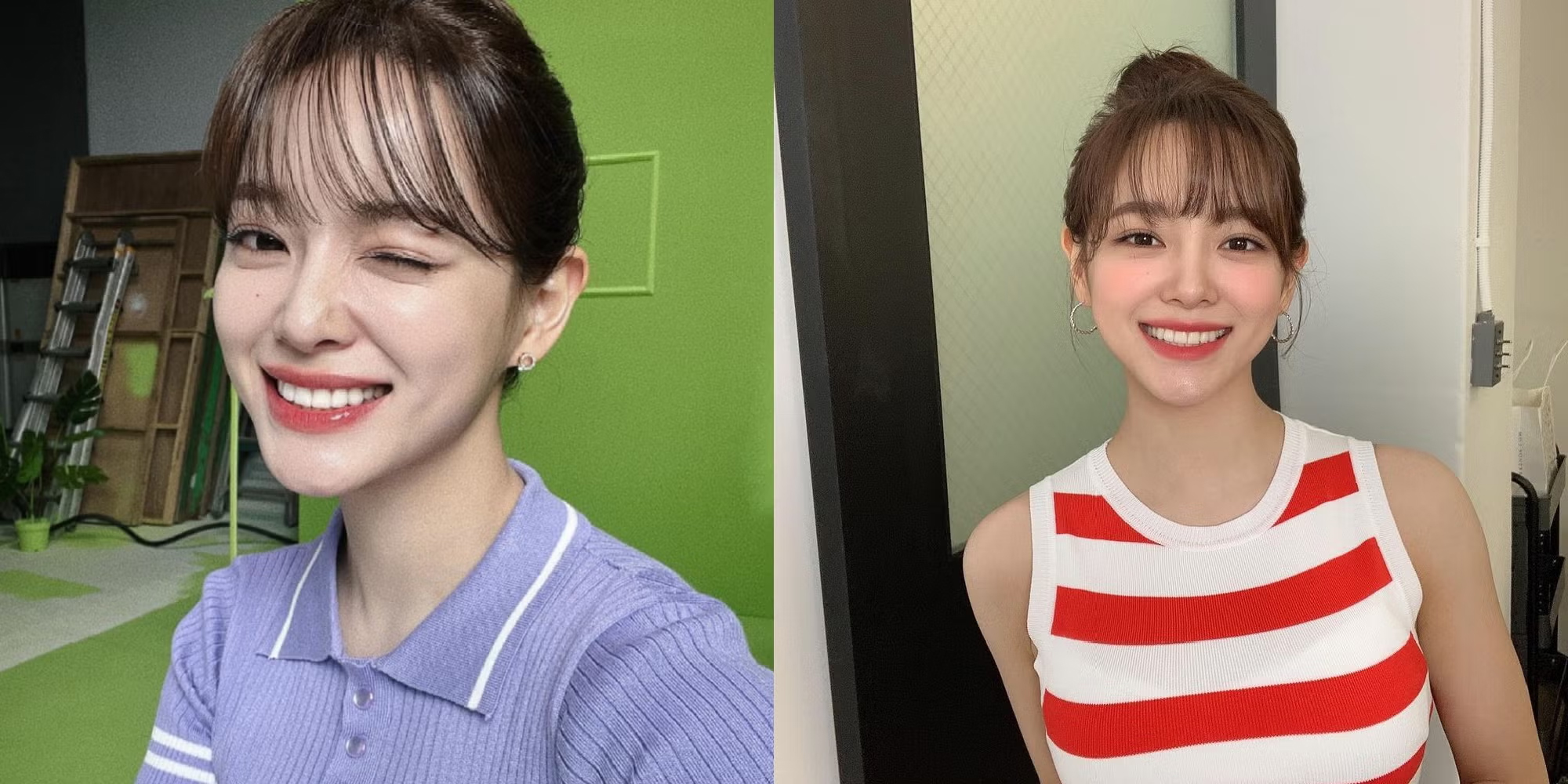 Nếu đang định thẩm mỹ răng trước Tết th&igrave; đ&acirc;y chắc chắn l&agrave; những điều bạn cần đọc ngay- Ảnh 4.