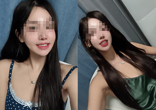 Nếu đang định thẩm mỹ răng trước Tết th&igrave; đ&acirc;y chắc chắn l&agrave; những điều bạn cần đọc ngay- Ảnh 3.