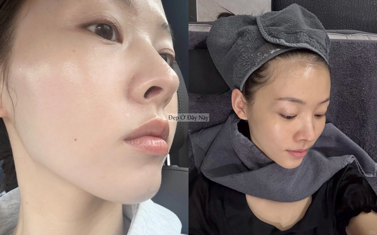 Bí quyết giúp da ngày một khỏe đẹp từ bên trong của cô nàng người Hàn Quốc- Ảnh 7.