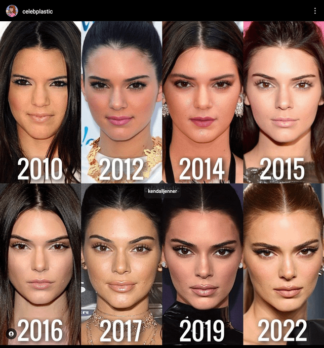 Kendall Jenner m&agrave; đẹp tự nhi&ecirc;n sao?- Ảnh 3.