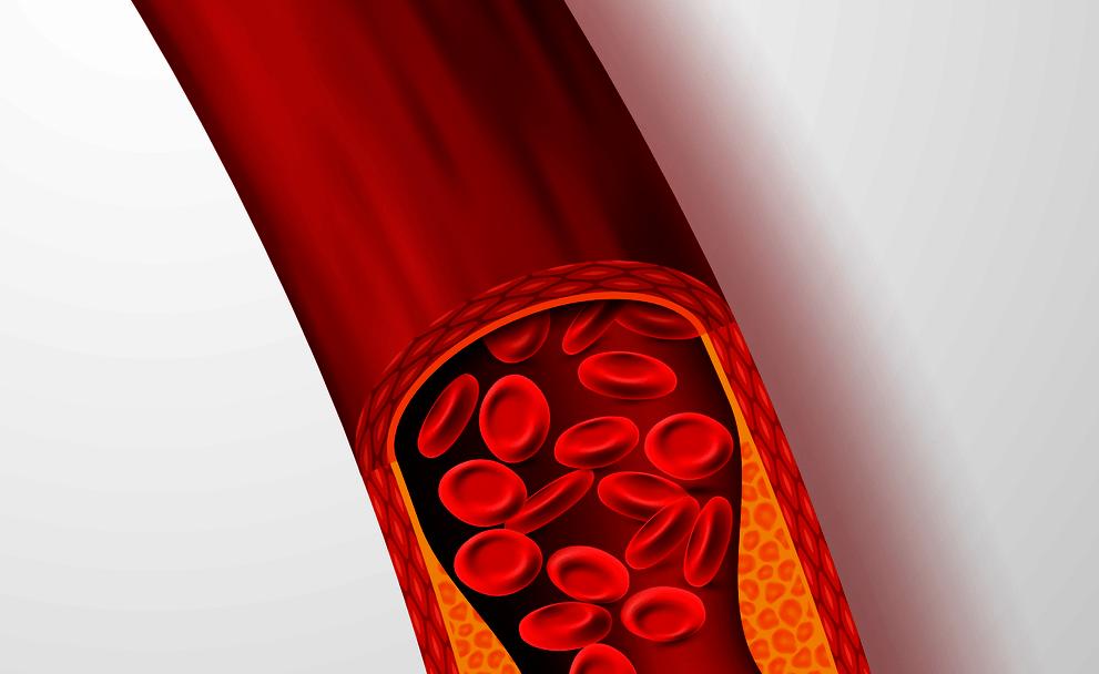 Kh&ocirc;ng phải thuốc, đ&acirc;y l&agrave; 5 nh&oacute;m thực phẩm khiến cục m&aacute;u đ&ocirc;ng &ldquo;sợ h&atilde;i&rdquo;: Nhiều gia đ&igrave;nh Việt vẫn kh&ocirc;ng biết m&agrave; ăn- Ảnh 1.