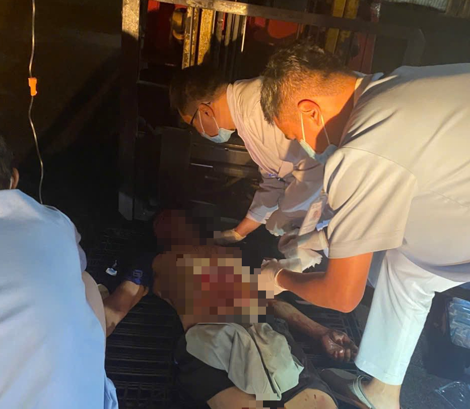 Một nam c&ocirc;ng nh&acirc;n bị m&aacute;y cuốn người g&acirc;y thủng bụng- Ảnh 1.