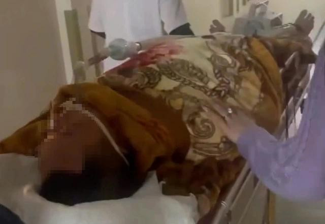 Người đ&agrave;n &ocirc;ng nguy kịch nghi nhiễm li&ecirc;n cầu khuẩn lợn sau khi ăn tiết canh d&ecirc;- Ảnh 1.