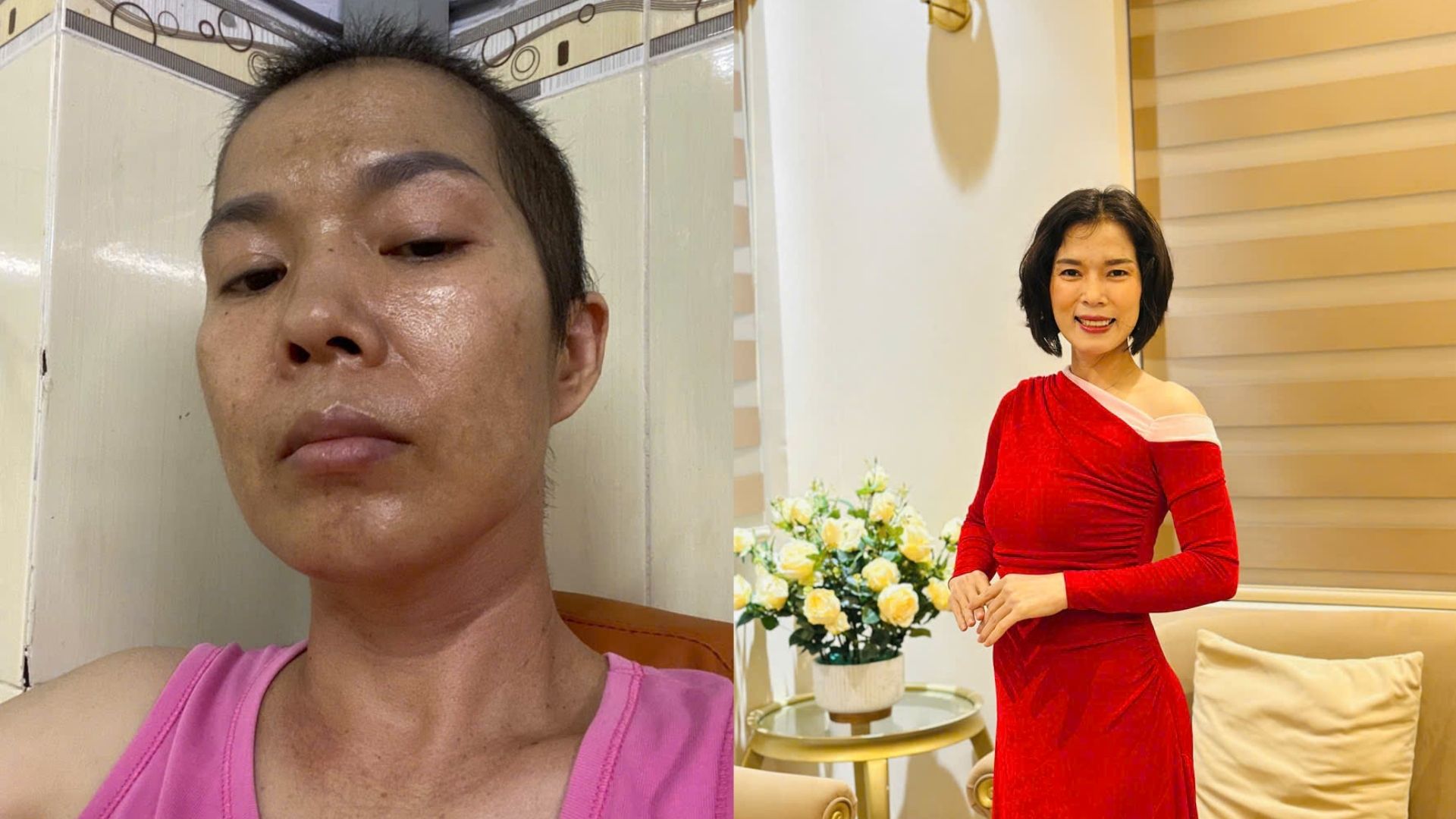 Phát hiện ung thư giai đoạn 3 đã di căn, 1 năm sau làm được điều không ai nghĩ tới: Tất cả nhờ vào 2 việc- Ảnh 1. Phát hiện ung thư giai đoạn 3 đã di căn, 1 năm sau làm được điều không ai nghĩ tới: Tất cả nhờ vào 2 việc- Ảnh 1.