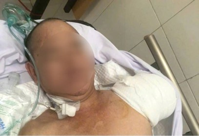 Từ 93 cuộc hội chẩn đến k&igrave; t&iacute;ch y khoa- Ảnh 1.