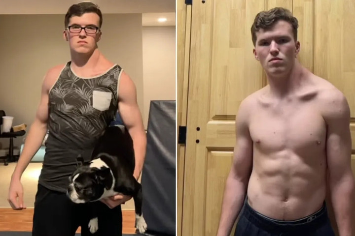 Chỉ tập một b&ecirc;n vai suốt 300 ng&agrave;y, ch&agrave;ng trai 19 tuổi nhận cảnh b&aacute;o từ b&aacute;c sĩ- Ảnh 1.