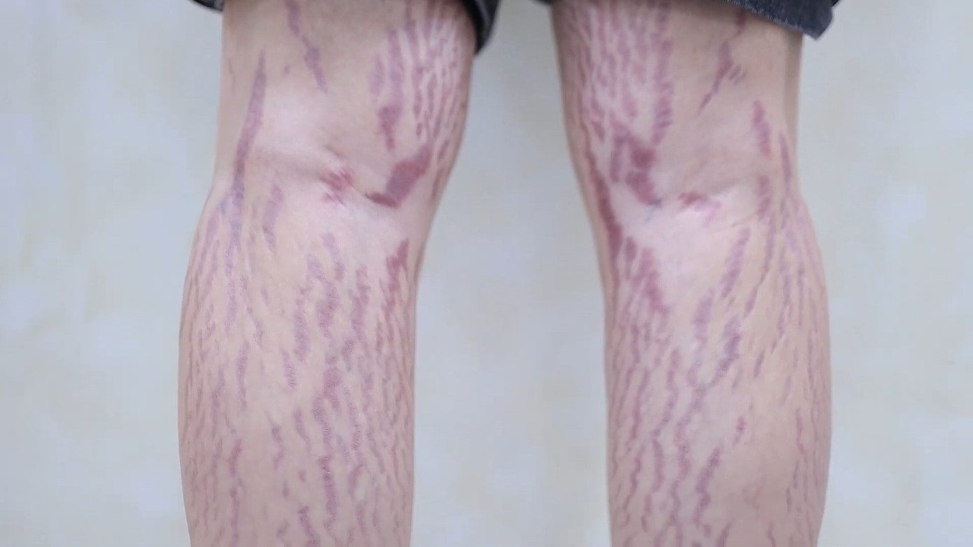 Dồn dập tai biến cao điểm l&agrave;m đẹp &lsquo;cấp tốc&rsquo; m&ugrave;a Tết- Ảnh 1.