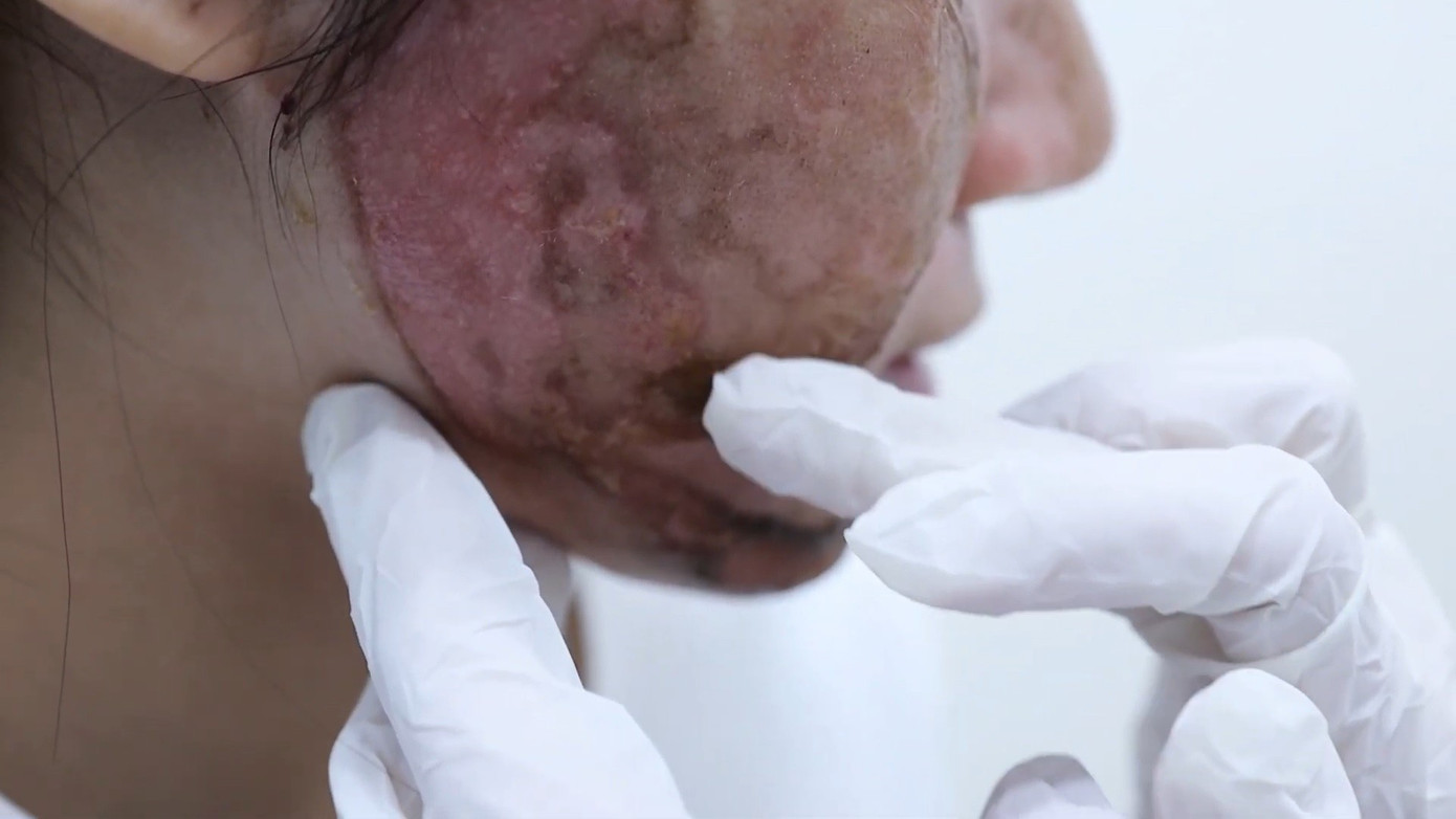 Dồn dập tai biến cao điểm l&agrave;m đẹp &lsquo;cấp tốc&rsquo; m&ugrave;a Tết- Ảnh 3.