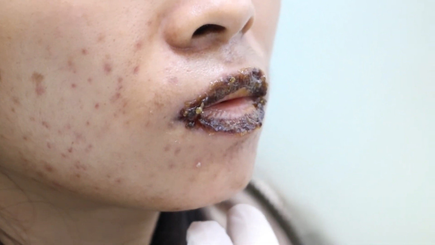 Dồn dập tai biến cao điểm l&agrave;m đẹp &lsquo;cấp tốc&rsquo; m&ugrave;a Tết- Ảnh 2.