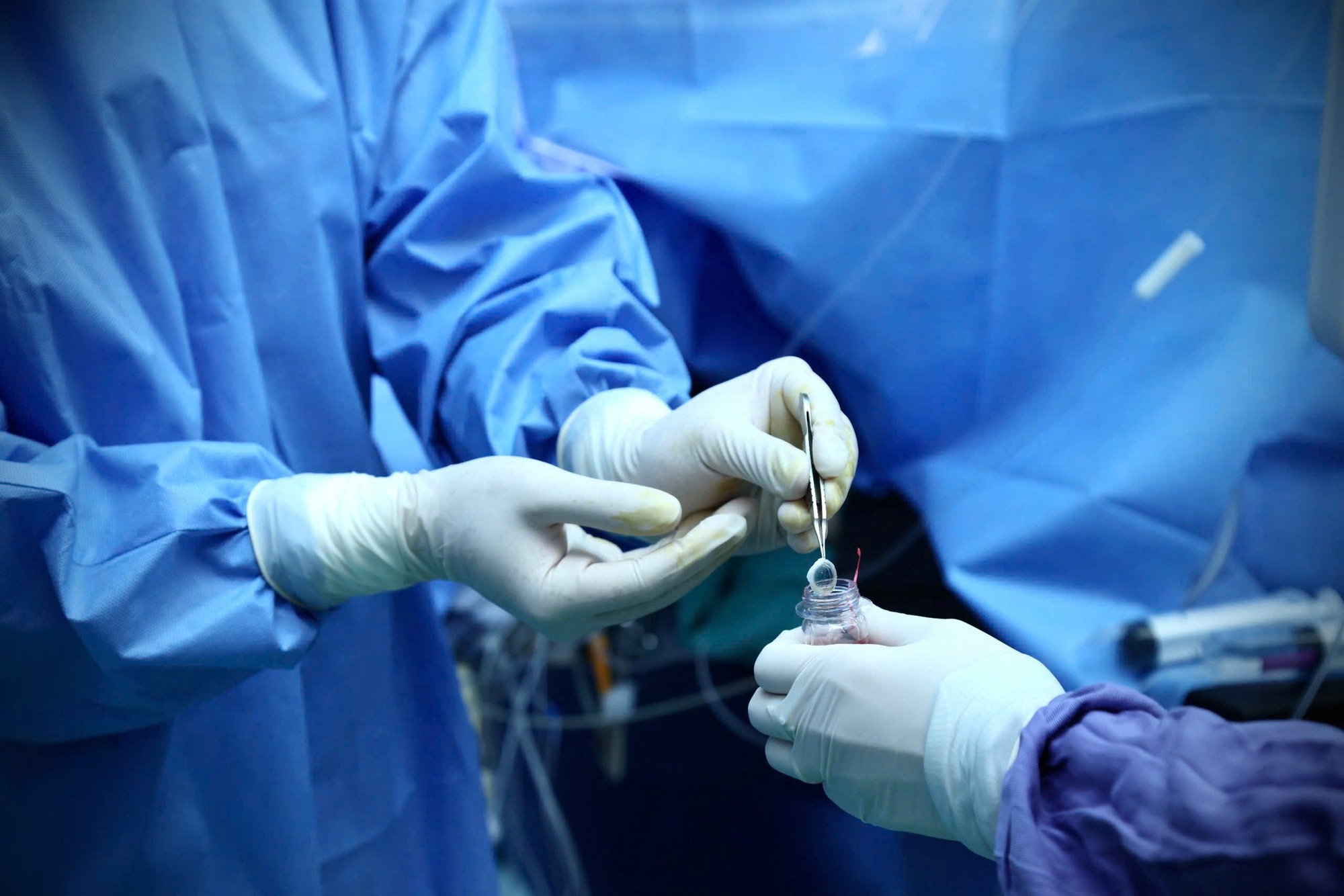 Nữ nh&acirc;n vi&ecirc;n y tế 46 tuổi hiến tạng sau chết n&atilde;o v&igrave; đột quỵ xuất huyết n&atilde;o: Đến gi&acirc;y ph&uacute;t cuối vẫn cứu sống nhiều người- Ảnh 2.