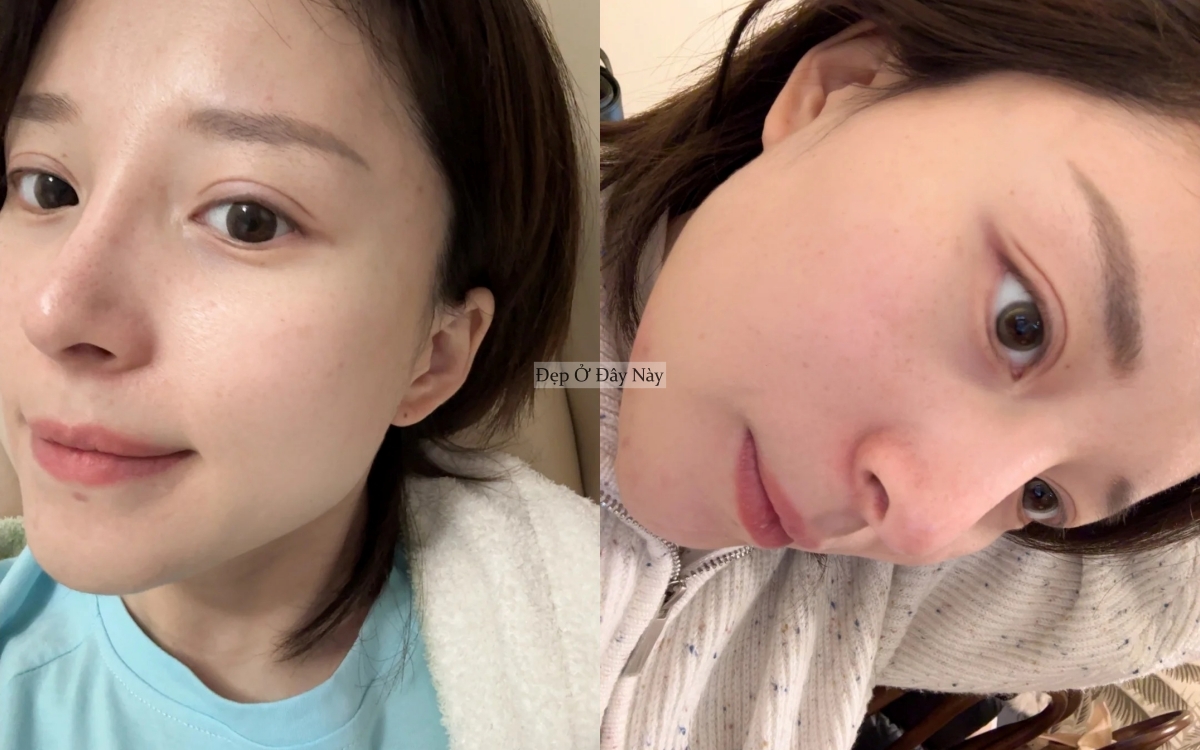 C&ocirc;ng thức dưỡng da "2 nhiều - 1 &iacute;t" gi&uacute;p t&ocirc;i được khen trẻ như g&aacute;i 18- Ảnh 3.