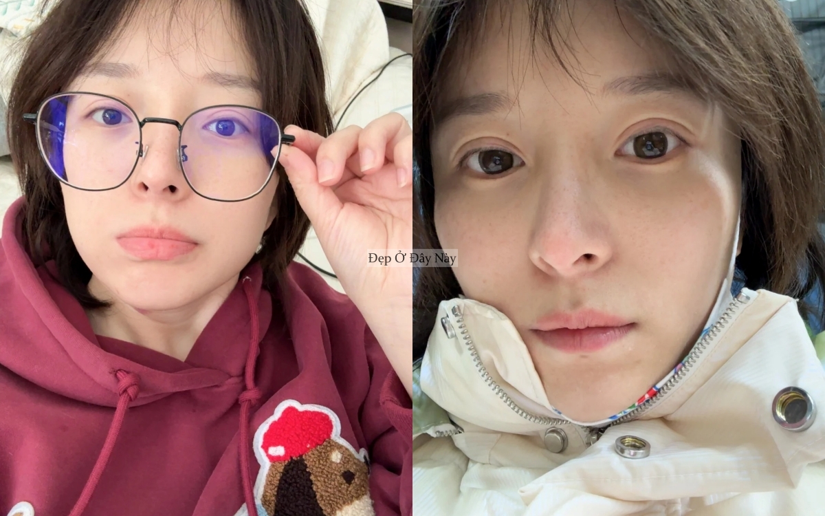 C&ocirc;ng thức dưỡng da "2 nhiều - 1 &iacute;t" gi&uacute;p t&ocirc;i được khen trẻ như g&aacute;i 18- Ảnh 5.