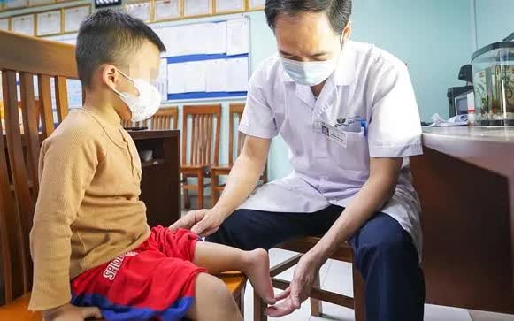 Xoay cẳng ch&acirc;n 180 độ tạo khớp gối mới cho b&eacute; trai 5 tuổi- Ảnh 1.