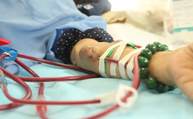 C&aacute;nh tay của người chạy thận h&oacute;a ra tr&ocirc;ng thế n&agrave;y: 1 vũ c&ocirc;ng chuy&ecirc;n mặc &aacute;o d&agrave;i tay 1 b&ecirc;n đ&atilde; "thức tỉnh" những ai kh&ocirc;ng biết- Ảnh 4.