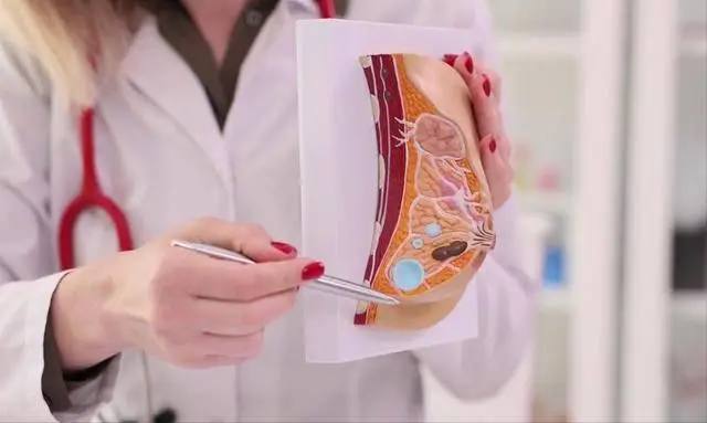 Phụ nữ sống thọ hay kh&ocirc;ng, nh&igrave;n v&agrave;o v&ograve;ng 1 l&agrave; thấy: 3 dấu hiệu ở ngực nhiều chị em xem nhẹ nhưng lại l&agrave; &ldquo;đ&egrave;n đỏ&rdquo; sức khỏe- Ảnh 3.